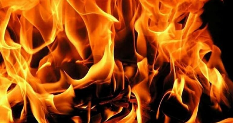 Kejadian Wanita Melecur Akibat Kebakaran Dapur